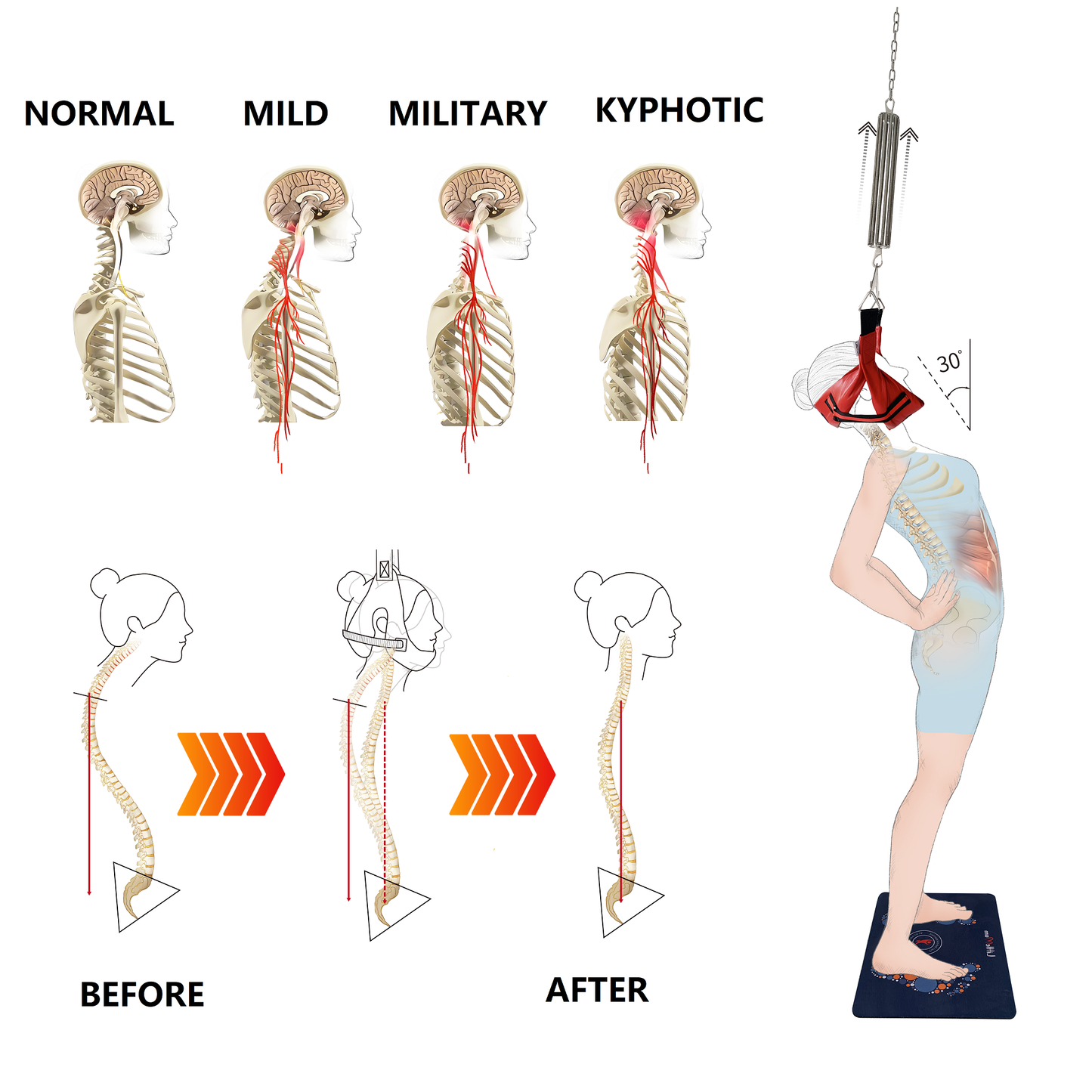 Spine decompression therapy