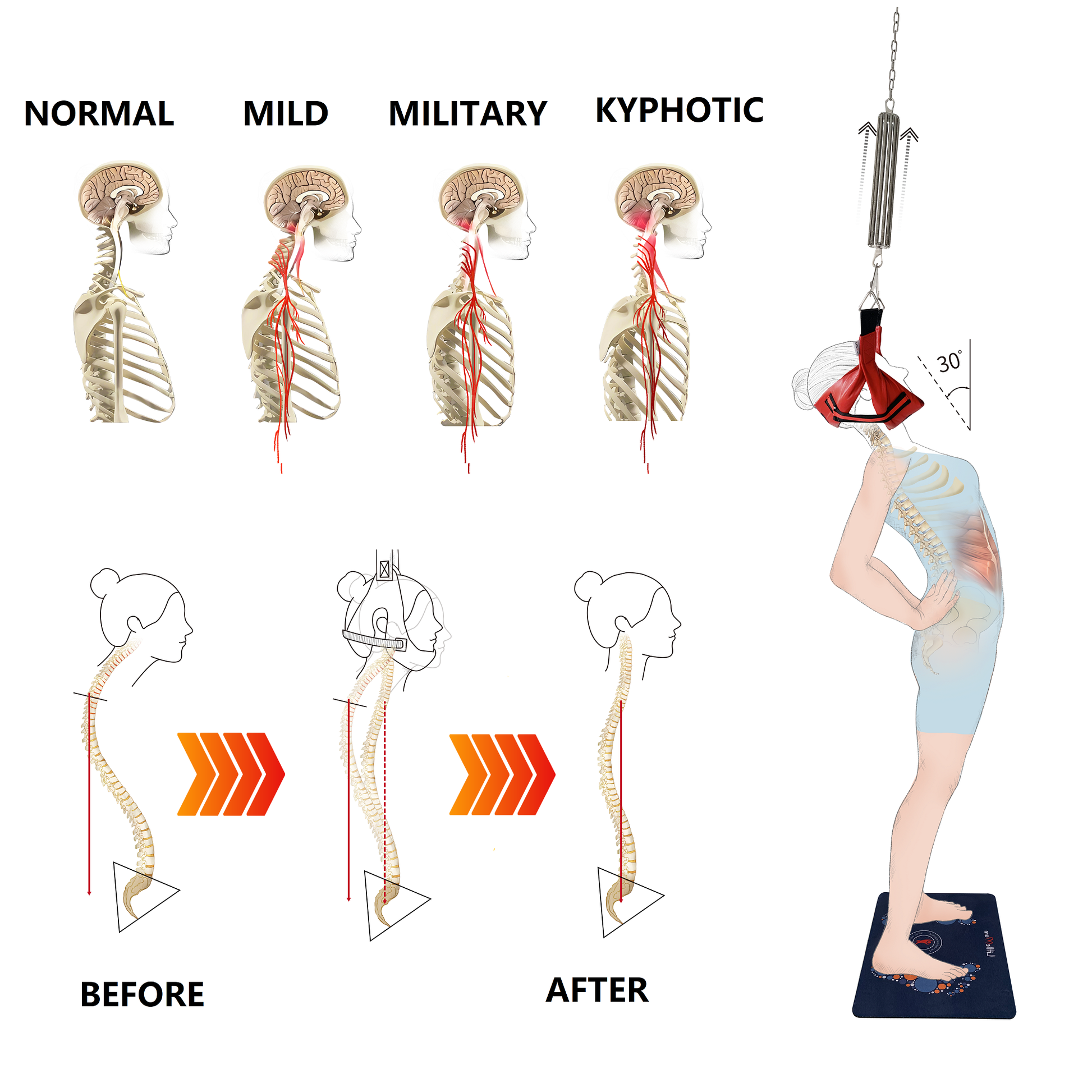 Spine decompression therapy